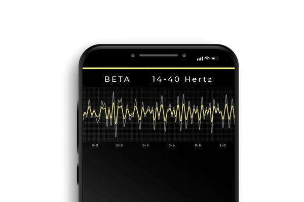 Beta Wellen Musik Frequenzen in einem EEG zu sehen