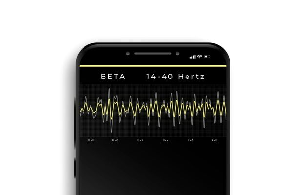 Beta Wellen Musik Frequenzen EEG Grau Beta Wellen Musik Frequenzen in einem EEG zu sehen