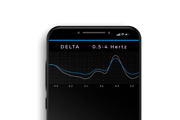 Delta Wellen Musik Frequenzen EEG Grau Delta Wellen Musik Frequenzen in einem EEG zu sehen