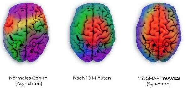 SMARTWAVES Wirkung Gehirnwellen EEG Gehirn visualisiert einfach